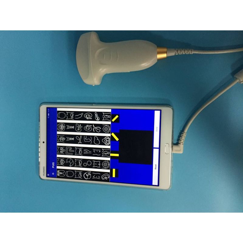 Hot sale Smart USB convex Wireless probe ultrasound potable medical scanner