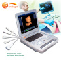 hot sale high intensity multifunction BW ultrasound diagnostic ultrasound machines equipment