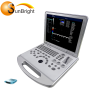 15-дюймовий РК-монітор 4D кольоровий доплерівський ультразвуковий сканер