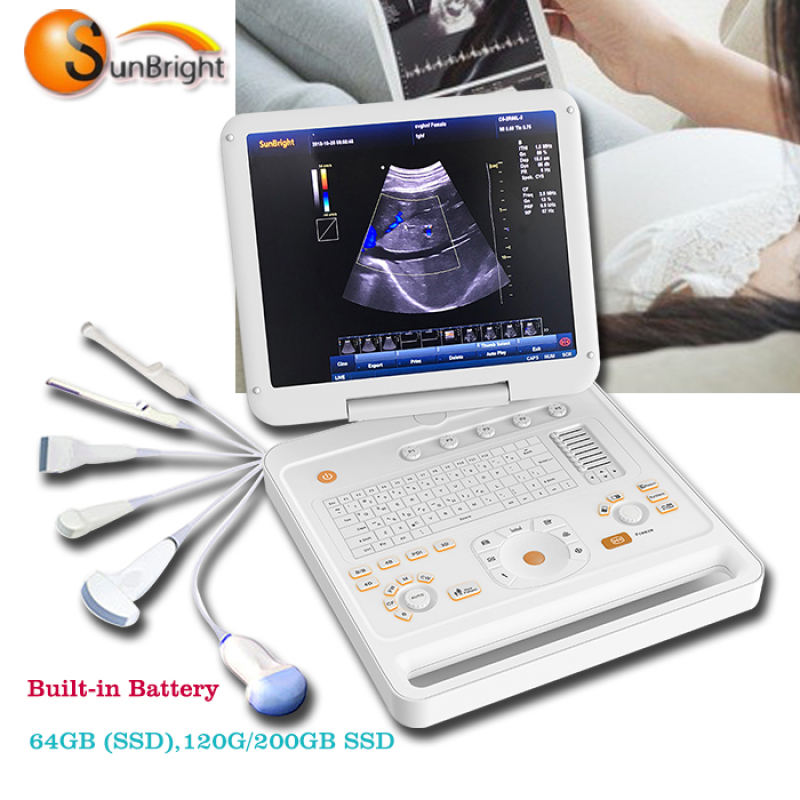 دوبلر الموجات فوق الصوتية المحمولة بأسعار معقولة 3D / 4D CW اللون دوبلر صدى بالموجات فوق الصوتية آلة لوحة ثنائي الفينيل متعدد الكلور للبيع