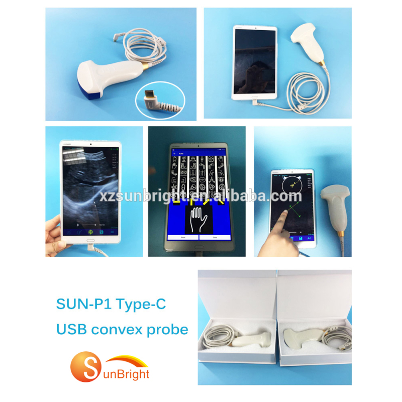 Medical homecare laptop ultrasound USB probe for mobilephone/Pad