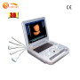 Portable laptop style Medical ecografo 3D ultrasound scanning machine 3D ultrasound scanner