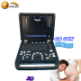 Portable 15 inches free 3D real-time laptop factory price ultrasound scanner china