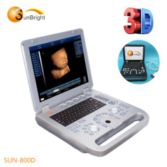Win7 platform Medical Pregnancy 3D portable ultrasound machine ebay
