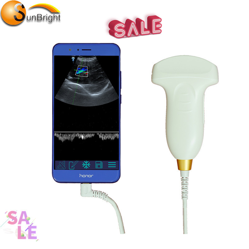 Hot-sale hand held color Doppler convex Scanner bluetooth ultrasound probe