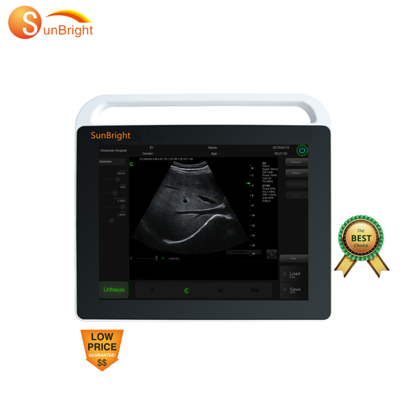 Popular ultrasound scan machine good clean image
