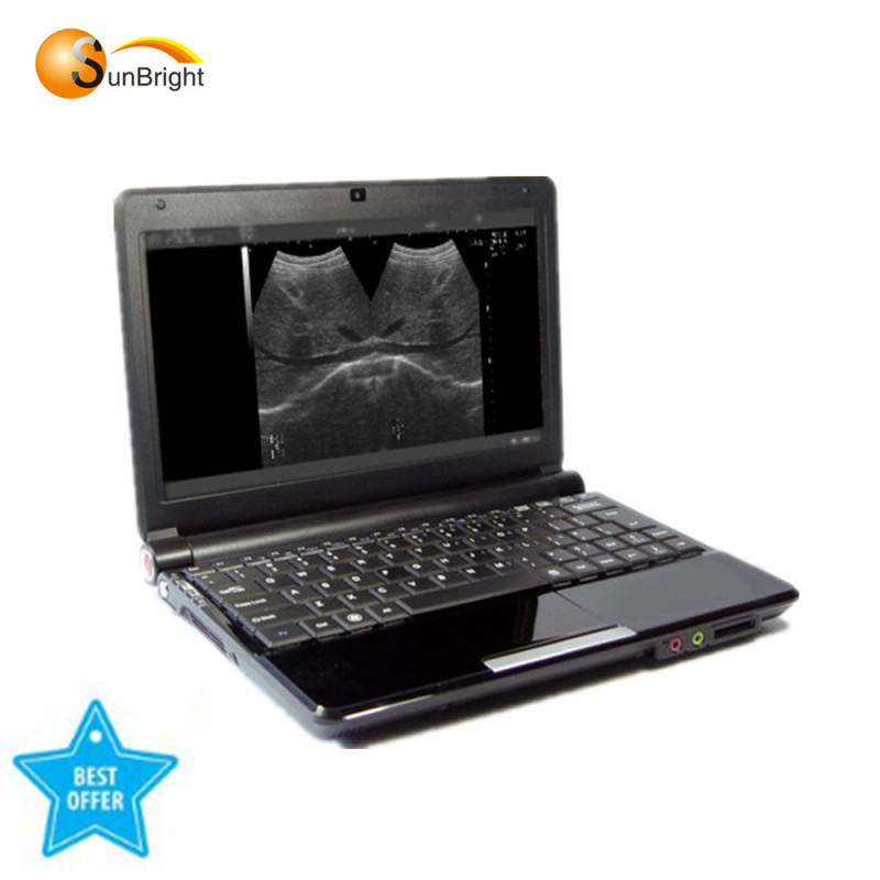Hot sale! Medical ultrasound machine B W MINI laptop ultrasound diagnostic equipment
