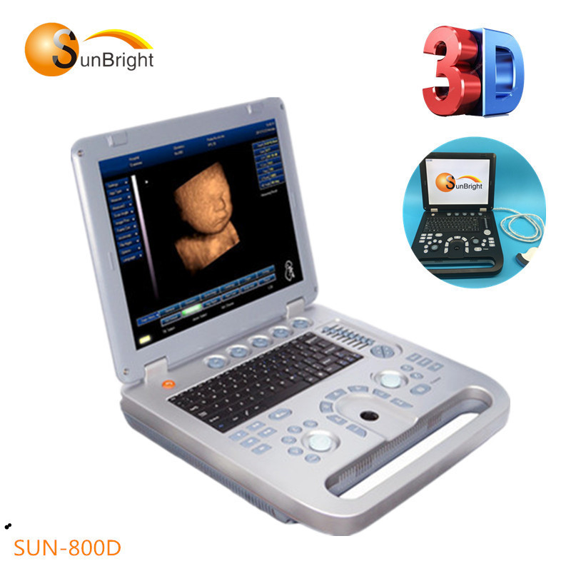 Nice quality best Ultrasound manufacturing cardiovascular ultrasound machine
