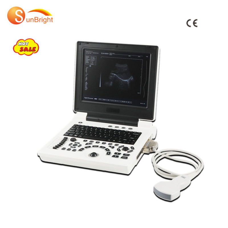 Medical Echocardiography 2D 3D image portable ultrasound device price