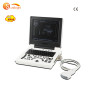 Medical Echocardiography 2D 3D image portable ultrasound device price