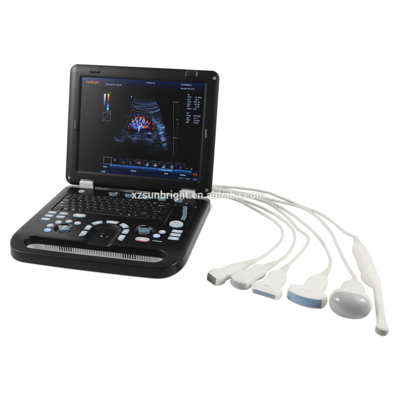 Cardiac 4D Color Doppler CW Echocardiography Echo Ultrasound Machine Price