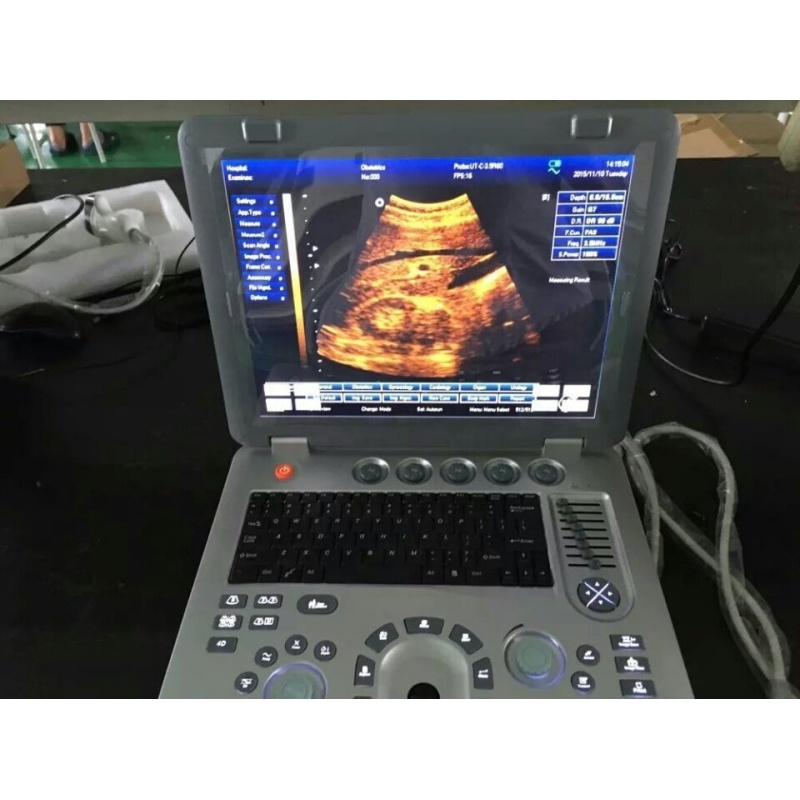 Factory price human use digital 3D ecografo USG portable ultrasonic ultrasound machine