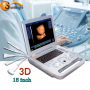 OB GYN laptop 3D medical ultrasound probe only clinic scanner SUN-800D