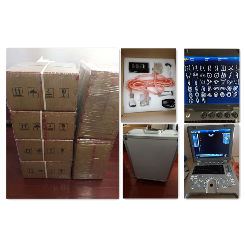 similar with medison ultrasound laptop 3D digital scanner