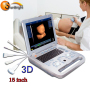 High resolution clear images Ecograph Laptop notebook Portable Color Ultrasound Machine