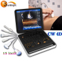 portable 4D ultrasound machine Doppler medical ultrasound