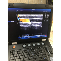 Vascular ultrasound elastography laptop 3D color doppler portable ultrasound machine low price
