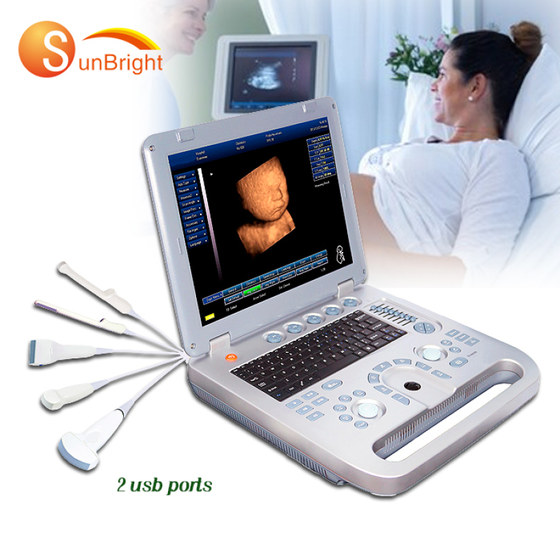 저렴한 Ecograph 휴대용 흑백 3D 컬러 초음파 기계 의료