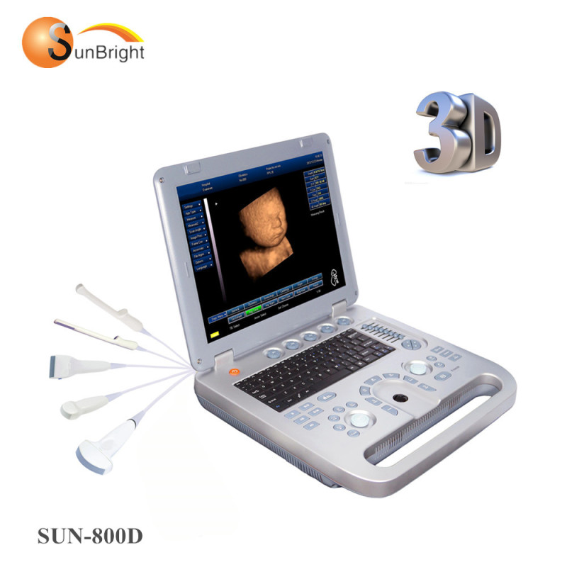 Il miglior costo della macchina per imaging ad ultrasuoni a basso costo ecografico portatile a ecografia 3D di alta qualità