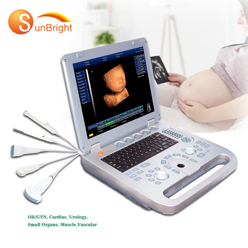 Hot sale CE Hospital Portable Black White Ultrasound machine Price ultrasound for sheep