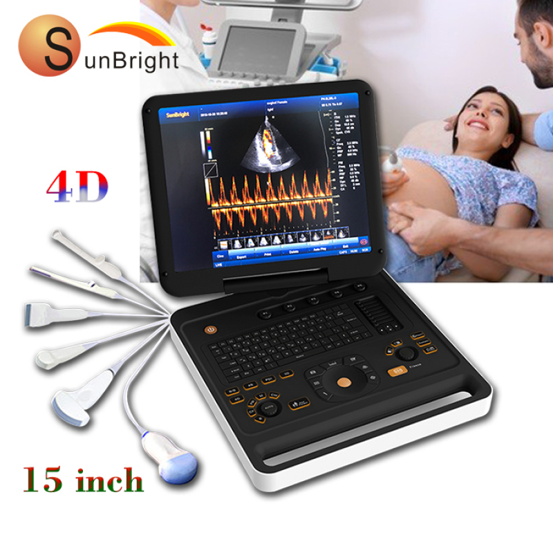 Best selling 4D color Doppler diagnostic ultrasound