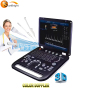 Newest 3D Echography Machine portable color doppler ultrasound Convex/Linear ecografia 4d