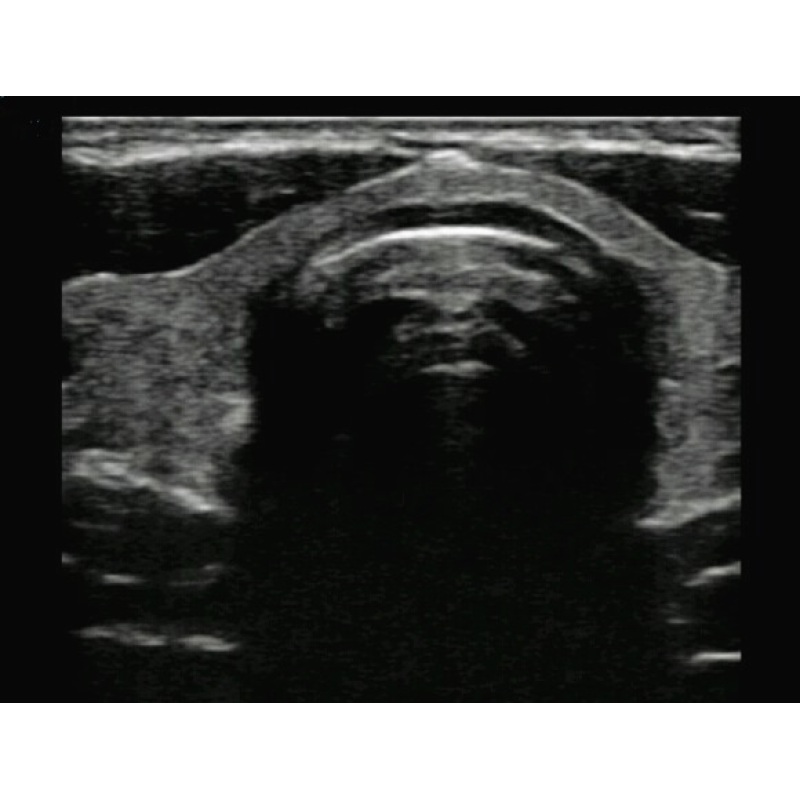 Factory price Portable ultrasound transducer gel Probe for sale