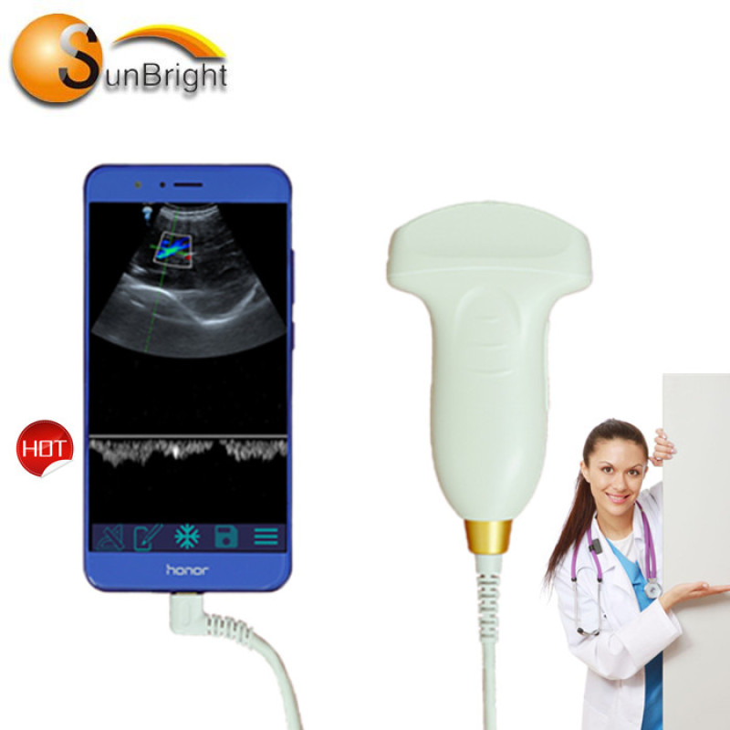 SUN-D1 mini ecografo palmare con sonda convessa USB e doppler a colori per ostetricia