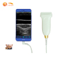 Hot sale Smart  factory price portable usb medical  ultrasound linear probe ultrasound for sale