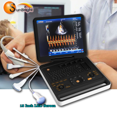 vet human use phased array continuous wave function 4D color Doppler ultrasound