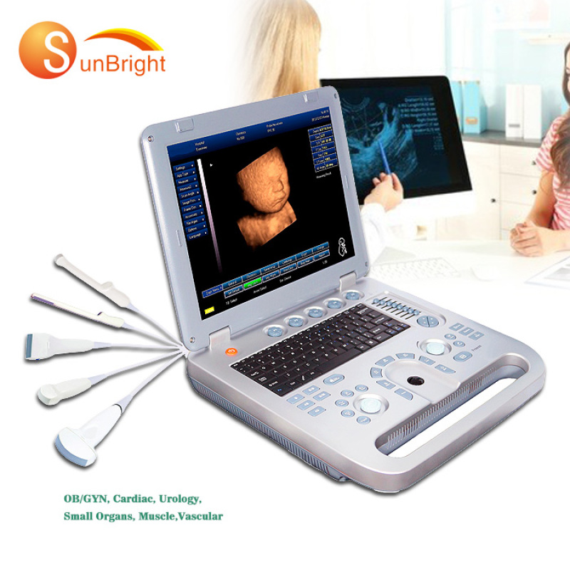 Transductor práctico portátil médico del eco del escáner del ultrasonido del funcionamiento del software libre 3D