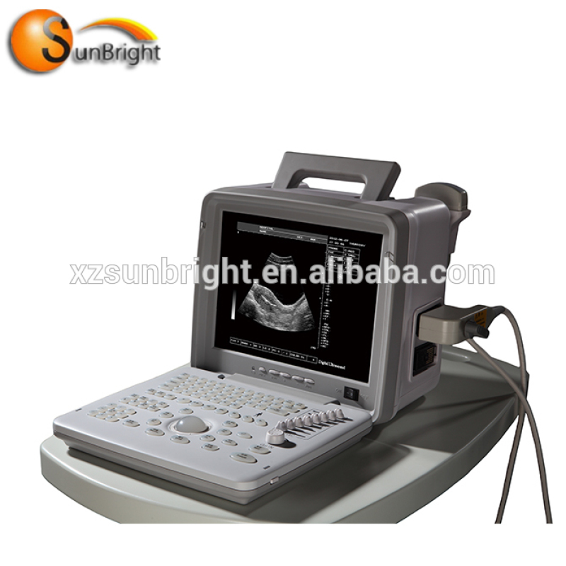 Настільний ультразвуковий мінісканер Sunbright SUN-806X