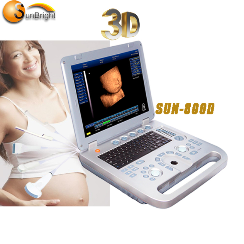 Портативний ультразвуковий ультразвуковий сканер Sunbright для лікарні