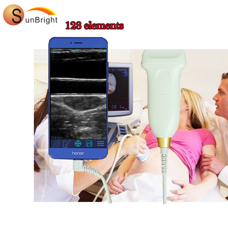 휴대용 초음파 장치 의료용 선형 USB 케이블 프로브 무선 컬러 도플러 초음파