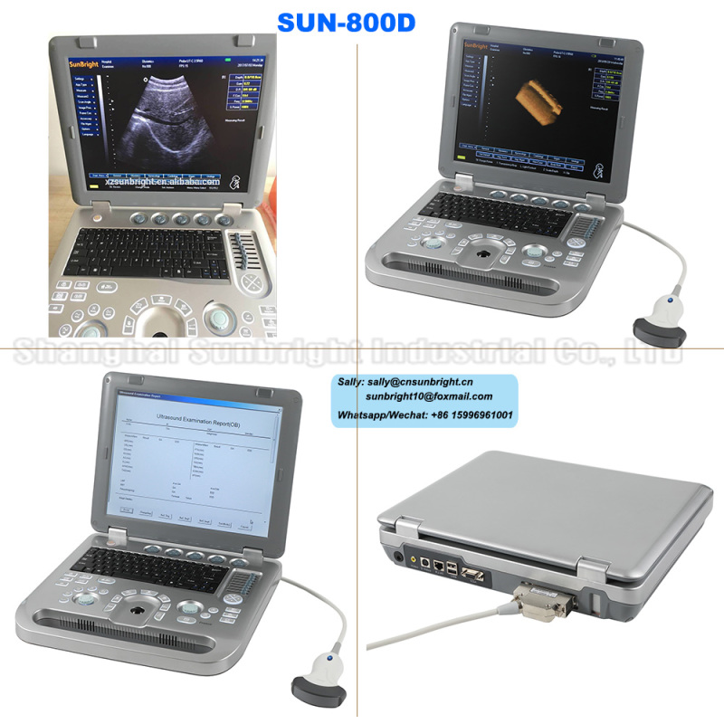 high quality lower price medical 3D portable diagnostic pregnancy echo ultrasound type machine price