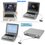 high quality lower price medical 3D portable diagnostic pregnancy echo ultrasound type machine price