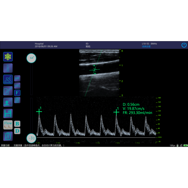 imago ultrasound machine for veterinary USB cell transducer