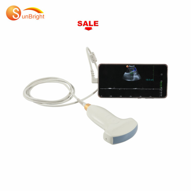 factory price high performance portable diagnostic usb probes ultrasound for sale