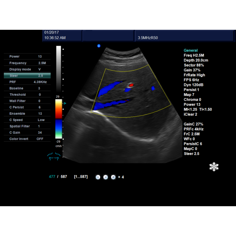 Image details clear view professional 4D ultrasound portable color doppler diagnostic