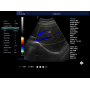 Image details clear view professional 4D ultrasound portable color doppler diagnostic