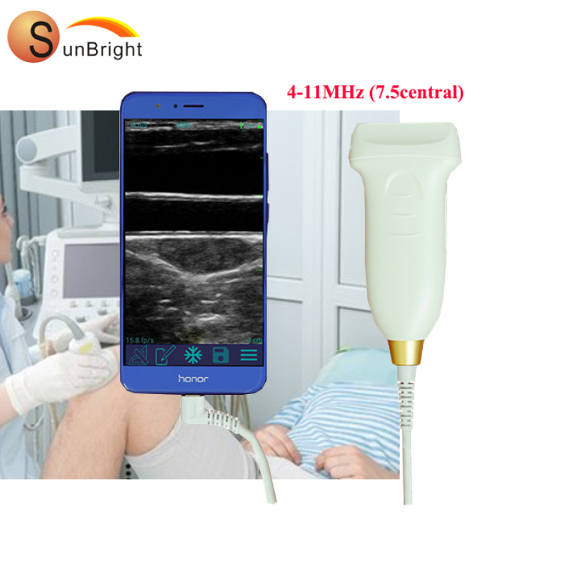 Innovative Design 2020 USB+WIFI iPad/iPhone/Android oem Wireless Convex/Linear Ultrasound Probe