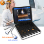 High end PW Vascular color Doppler ultrasound 3D 4D ultrasound machine price