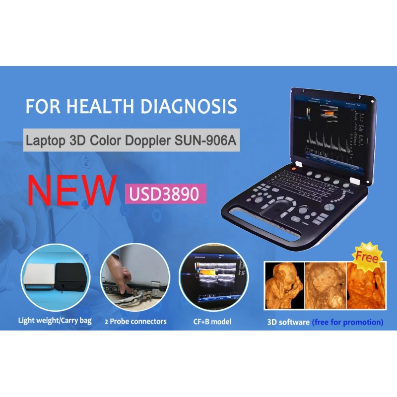 High-end Portable Color Doppler 4D Veterinary Sheep Bovine Ultrasound Equipment,Pregnant Ultrasound