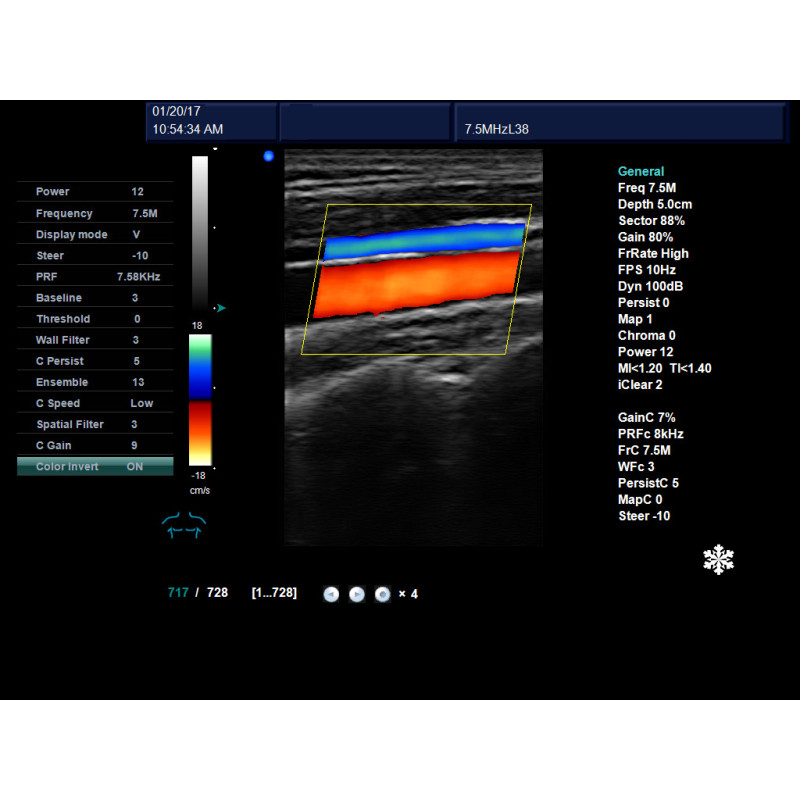 Image details clear view professional 4D ultrasound portable color doppler diagnostic