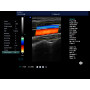 Image details clear view professional 4D ultrasound portable color doppler diagnostic