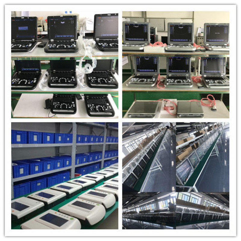 Factory price portable 3D 4d echocardiography ultrasound USG