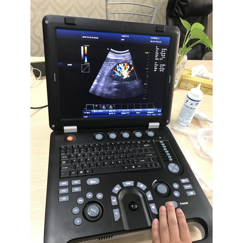 medical equipment 3D 4D Obstetrics color doppler ultrasound price