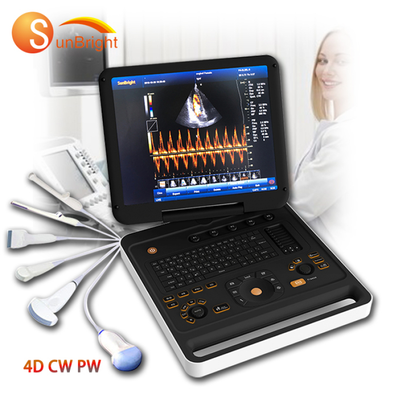 máquina de ultrasonido doppler color 3D 4D portátil médica de alta intensidad avanzada