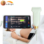 High Quality Latest Portable Smartphone Ultrasound Machine USB Probe Price