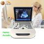 buy ultrasound Portable PC-based Convenient carry function ultrasound machine